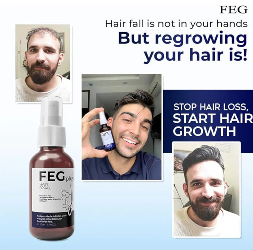 FEG Hair Growth Spray Plus Derma Roller, Suitable For Both Men and Women