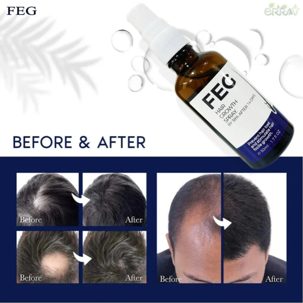 FEG Hair Growth Spray Plus Derma Roller, Suitable For Both Men and Women