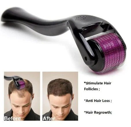 FEG Hair Growth Spray Plus Derma Roller, Suitable For Both Men and Women